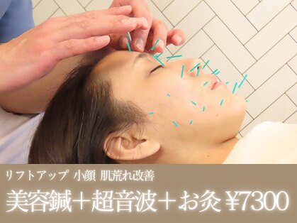 いん鍼灸治療院の写真