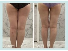 ルミナ(RUMINA)/塗るだけでも効果抜群！？