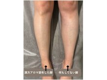 漢方アロマを塗るだけで！むくみがスッキリ♪むくみ効果抜群です