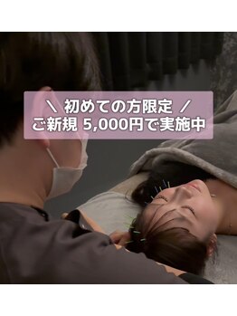 アロエベル(aloe Belle)/美容鍼初回5000円から可能★