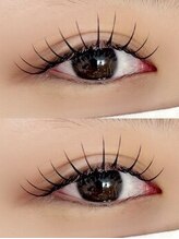 シュピネ(Choupinet)