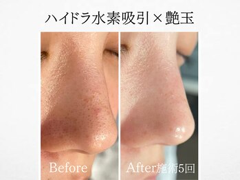 アンドミルル(and Milulu)/【ハイドラ水素吸引×艶玉】