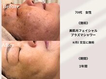 ティアラ 葛西店(TIARA)/70代女性　2年間