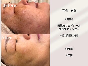 ティアラ 葛西店(TIARA)/70代女性　2年間