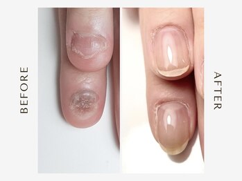 イロ ネイルアトリエ(iRo nail atelier)