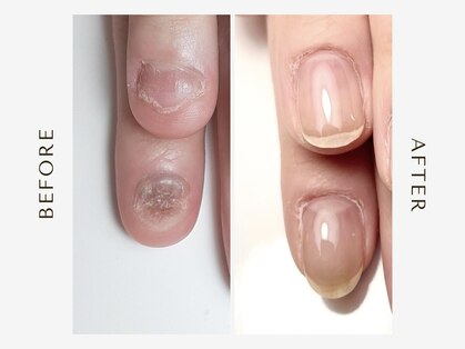 イロ ネイルアトリエ(iRo nail atelier)の写真