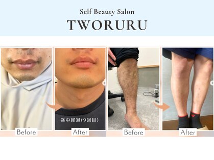 つるる(TWORURU)の写真