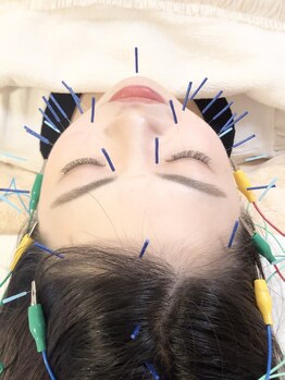 瑞 鍼灸院/美容施術♪