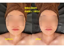 華月(KAGETSU)/小顔フェイシャル 初回2,980円