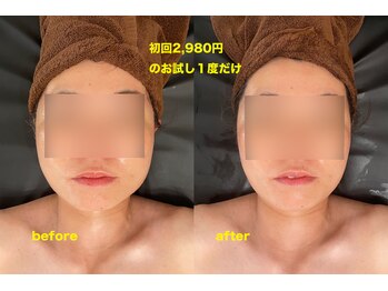 華月(KAGETSU)/小顔フェイシャル 初回2,980円