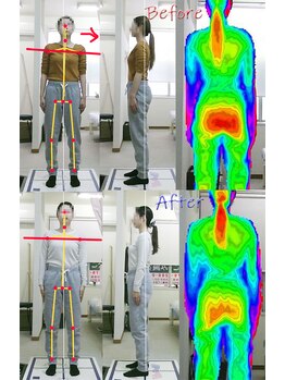 姫路なごみ整体院 なごみ鍼灸院/(改善例)　右腰痛み・首痛・歪み