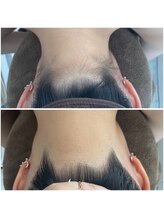 ミース 北九州店/うなじ●ビフォーアフター