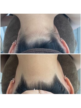 ミース 北九州店/うなじ●ビフォーアフター