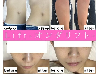 リフト 川崎(Lift)の写真