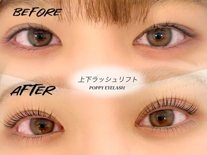 ポピーアイラッシュアンドエイジングケア(POPPY eyelash)の写真