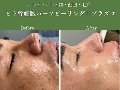 イロハ(IROHA)の写真