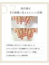 ピノ(pino)/◆深爪矯正＋定額デザイン◆