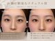 エミュ(e'mu)の写真