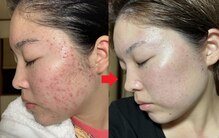 ファニービー 吹田店