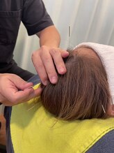 鍼灸院接骨院テトテ(tetote)/施術風景