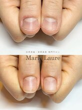 マリーロール 淀屋橋本店(Marie Laure)/自爪育成/深爪矯正/ネイルケア