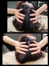 アラキ(ARAKI)/小顔矯正