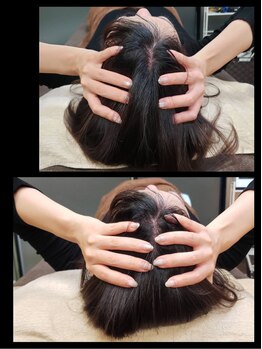 アラキ(ARAKI)/小顔矯正