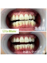 ルブラン 奈良店(Le Blanc)/お試しでもトーンアップ♪