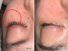 レイル(REIR)の雰囲気（肌悩み諦めないで！素肌美人は日々のお手入れがとっても重要◎）