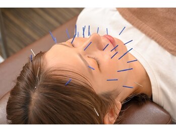 共立総合整骨院 八王子院/美容鍼はお肌以外の全身に効果◎