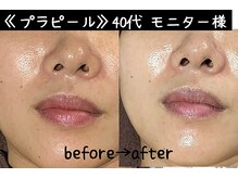 サロンスペースの雰囲気（韓国最新ピーリング【プラピール】40代 女性の方）