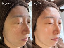 サロン ベレ プー(Salon Belle Peau)/before/after