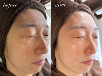 サロン ベレ プー(Salon Belle Peau)/before/after
