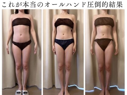 フォルスボーテ(Force Beaute)の写真