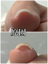 リラフ(Re:laugh)/