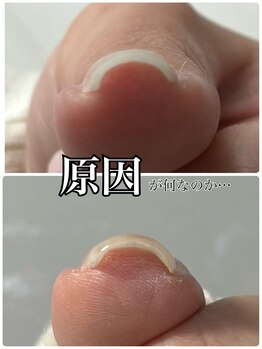 リラフ(Re:laugh)/