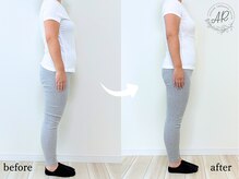 エーアール(AR)/【Before/After】4回目