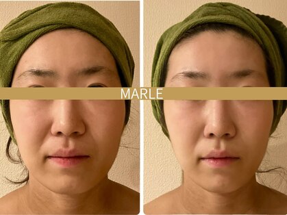 マルレ(MARLE)の写真