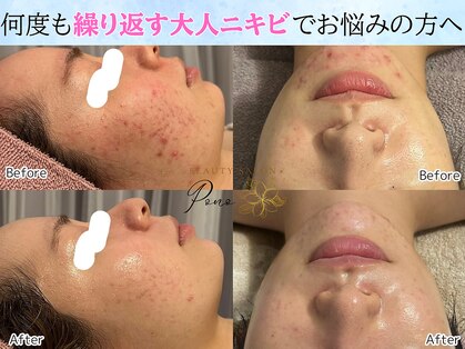 ポノ(Pono)の写真