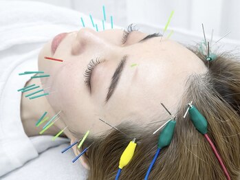 伊藤接骨院の写真/【初回2980円】電気を流す美容鍼でお顔全体の引き上げ、引き締めを実現♪むくみ・肌質改善・眼精疲労にも◎