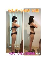 リオンズ 茨城ミスターマックス取手店/セルバーン付き　24回　40代女性