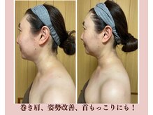 ハンナリ(Hannari)の雰囲気（姿勢改善（巻き肩、猫背）も同時に改善、バストUPも叶う）