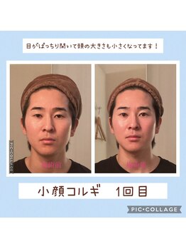 小顔コルギ専門店 フェルーシュ 成田駅前店(Feruche)/小顔コルギ