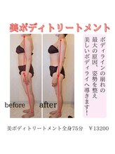 ブライトサロン(Bright Salon)/美ボディ！ボディトリートメント