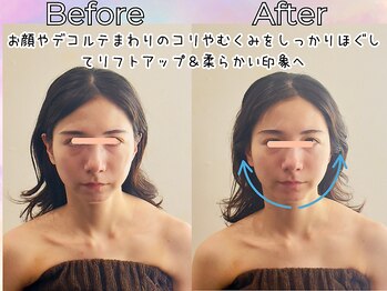 リストアハート(Restore Heart)/顔やデコルテのむくみがスッキリ