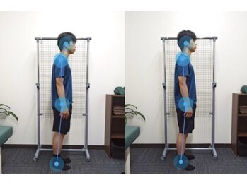 整骨院こころ 曙院/ビフォーアフター