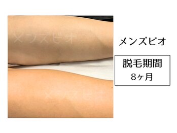 メンズビオ 神戸三宮店/