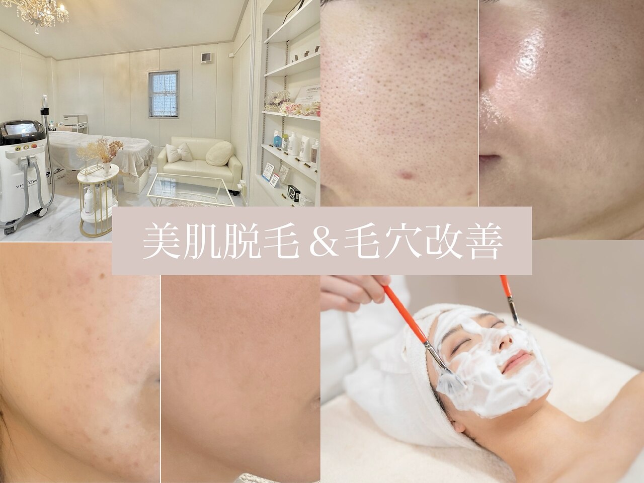 知立市で毛穴ケアが人気のエステサロン｜ホットペッパービューティー