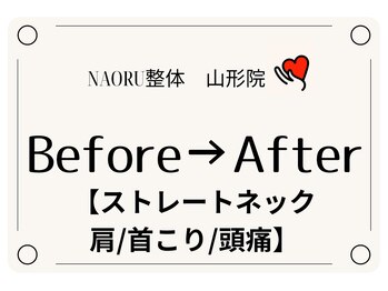 ナオル整体 山形院(NAORU整体)/Before→After