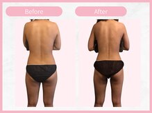 RHB東戸塚/痩身エステはRHB東戸塚